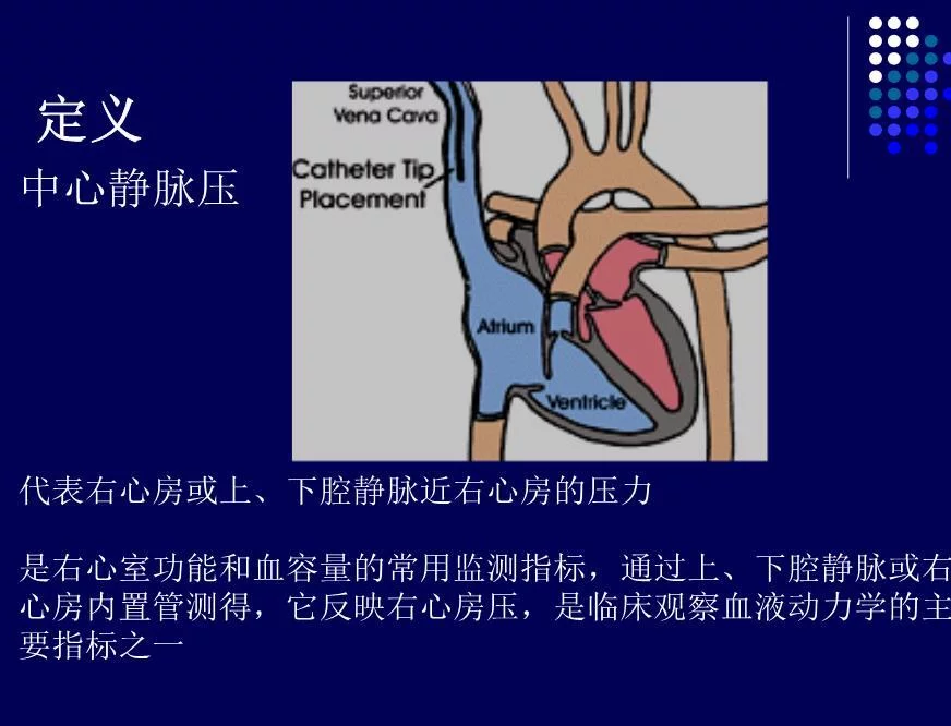 中心静脉压的监测与护理ppt课件
